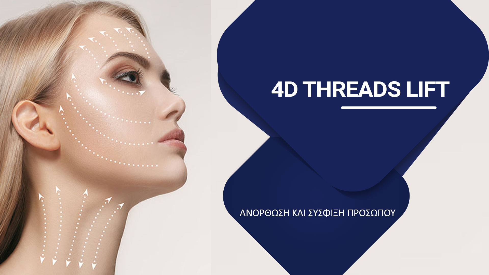 4D-THREADS-LIFT