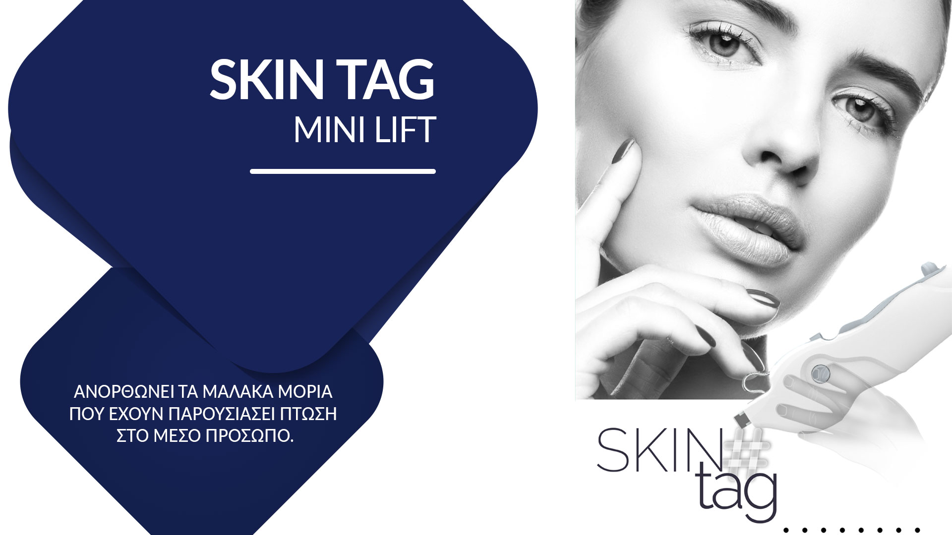 SKIN-TAG